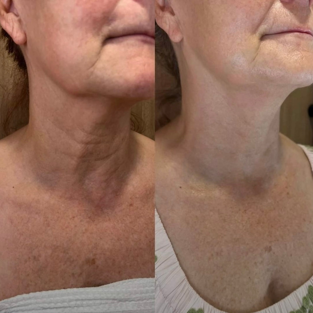 AURALIS™ – Vita-A Retinal Shot
Avancerad hudbehandling