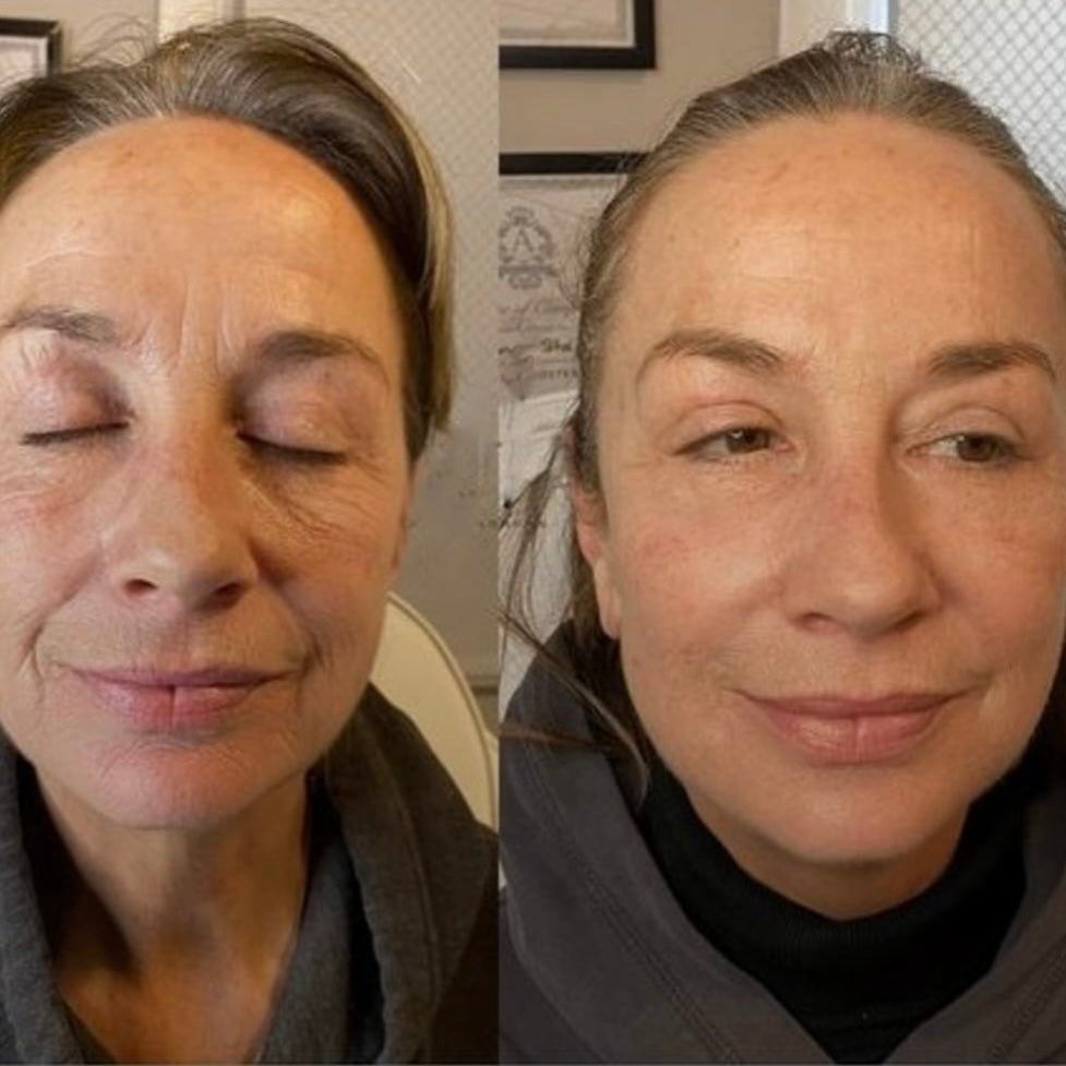 AURALIS™ – Vita-A Retinal Shot
Avancerad hudbehandling