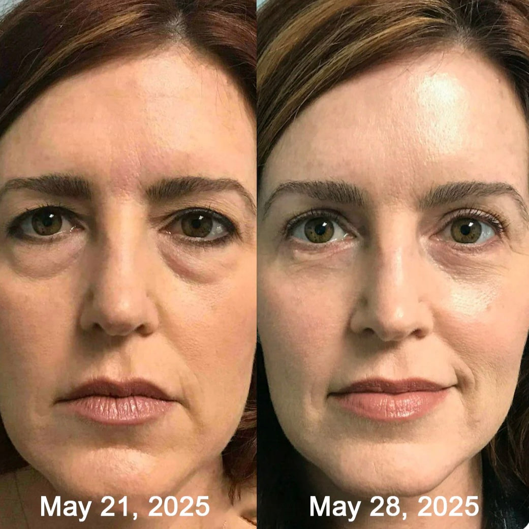 AURALIS™ – Vita-A Retinal Shot
Avancerad hudbehandling