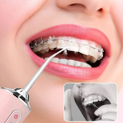 SmartFloss Pro – Professionell rengöring där tandborsten inte når