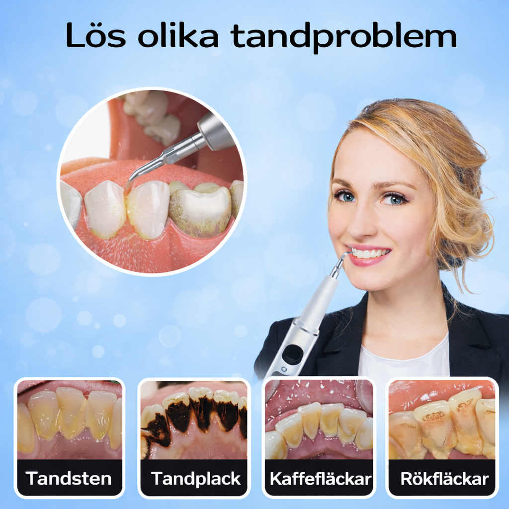 SmartFloss Pro – Professionell rengöring där tandborsten inte når